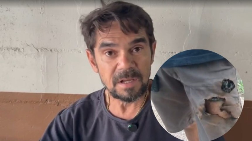 Fue atacado salvajemente por dos perros callejeros y la explosión de la batería de su celular le salvó la vida